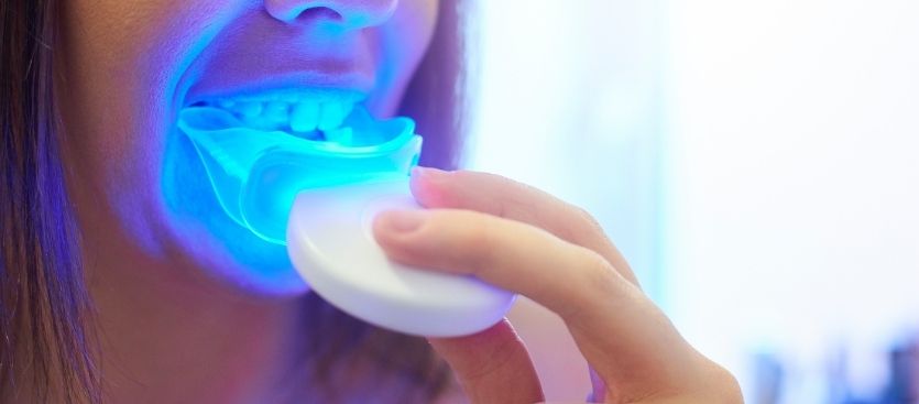 blanqueamiento dental en casa