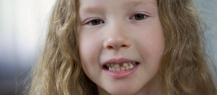 higiene de la ortodoncia infantil