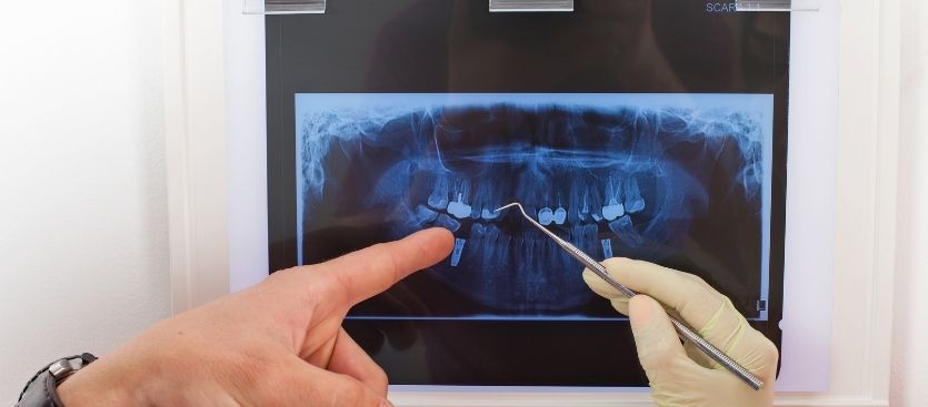 tipos de radiografias dentales