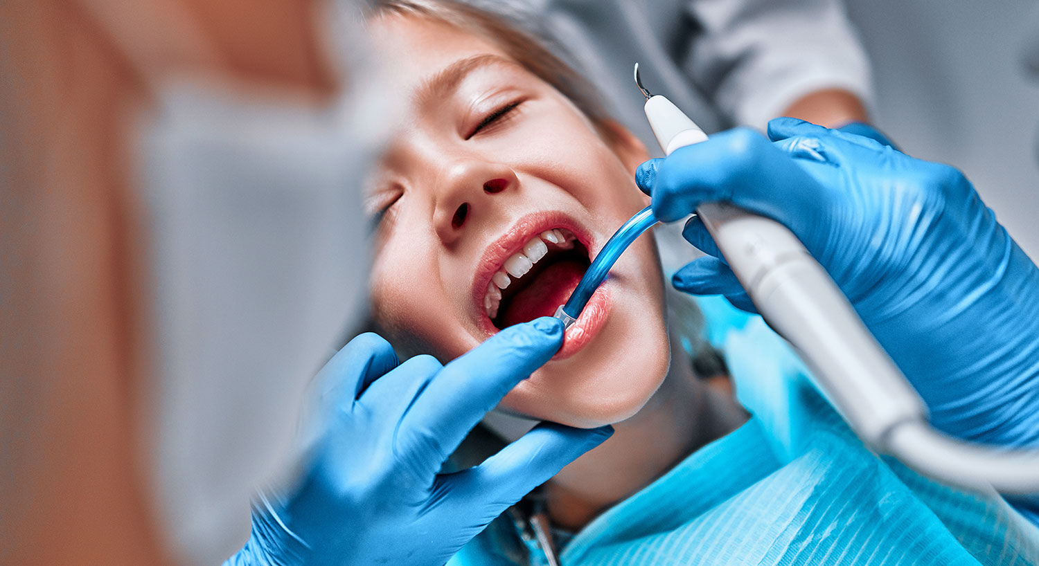 Cirugia oral