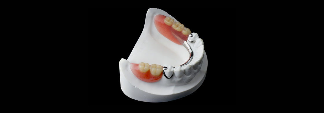 Protesis dental completa y removible